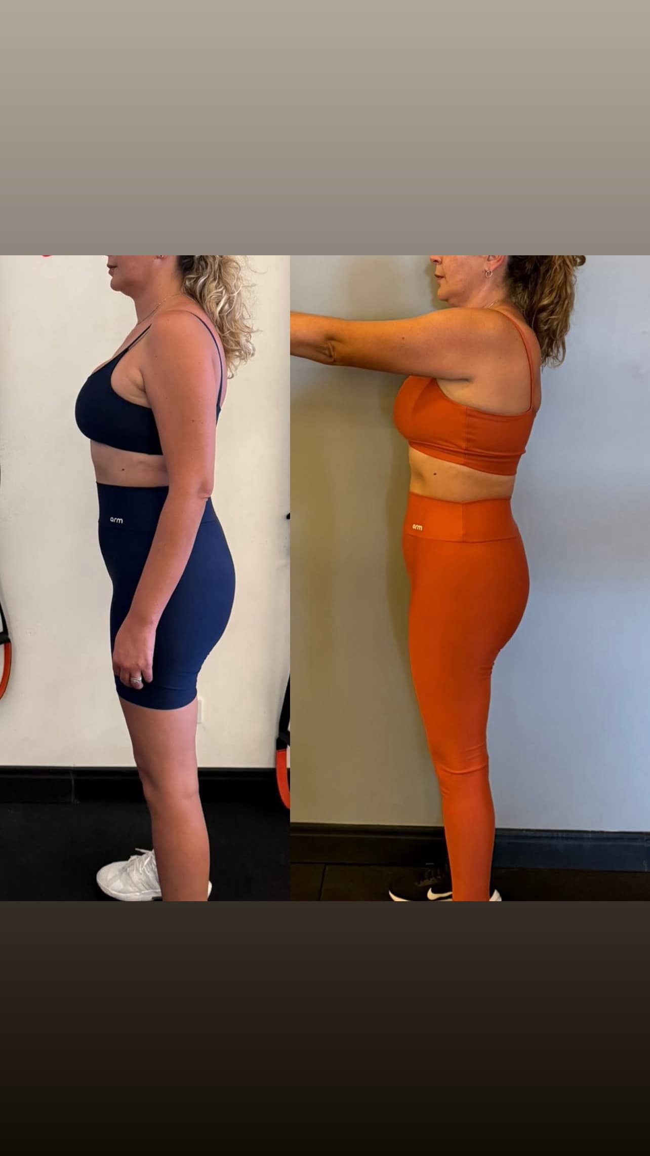 Registro de evolução de paciente em roupa de treino, perfil lateral.